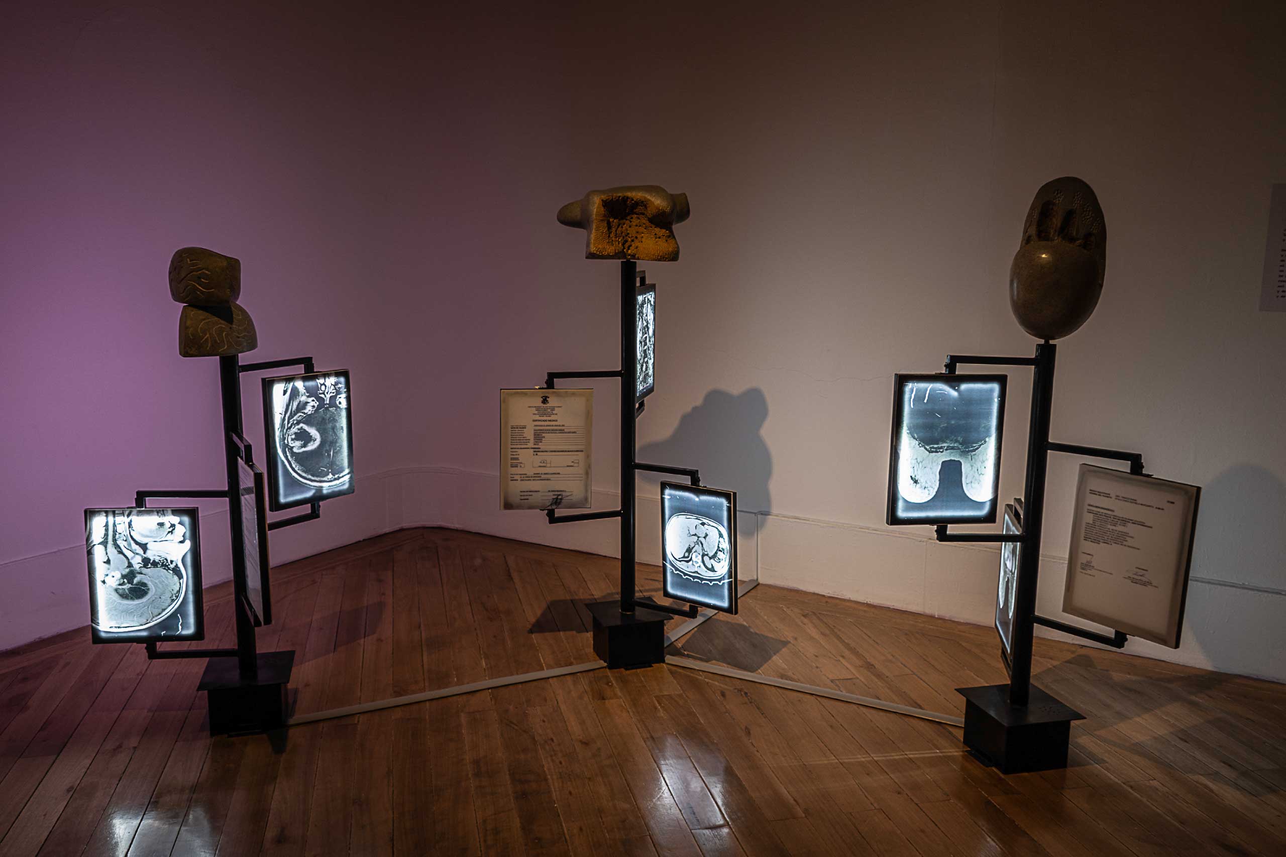Tres esculturas verticales con cajas de luz que muestran resonancias magnéticas y documentos médicos, coronadas por formas orgánicas de piedra, sobre una sala de paredes malva